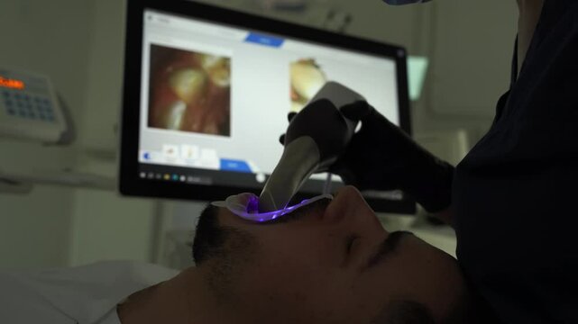 Dental 3d scanner applying process 4k video. Digital impressioning teeth of patient with 3d digital dental scanner.