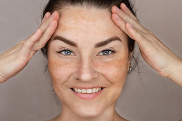 Caucasian woman's face with freckles or age spots, melasma