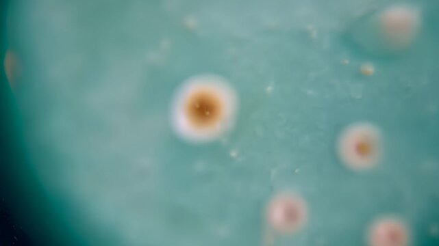 Close Up View of Bacteria Colonies on Agar Plate