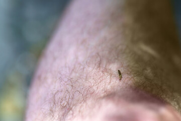 Mosquito biting a man's leg with curly hair.