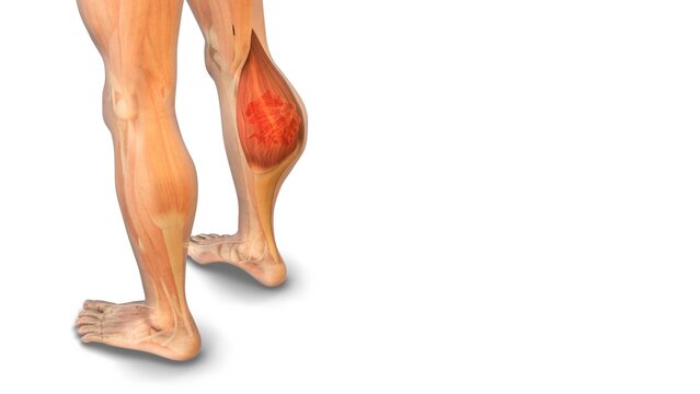 Medical animation of the fibrosarcoma tumor