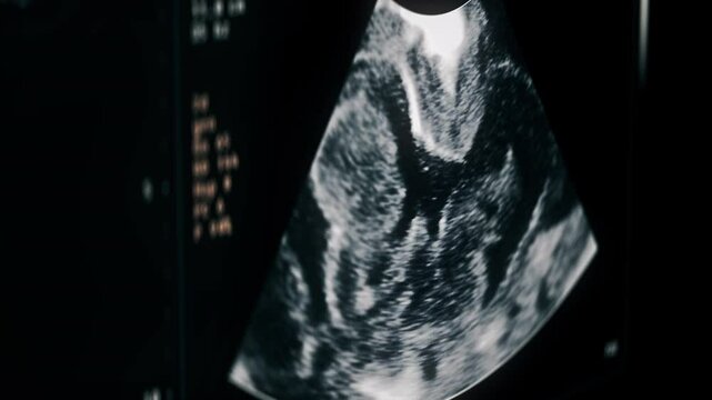 Scanner checking the condition of the baby in the womb. Scanner deals with the baby health check at the hospital. Scanner checking the growth of the baby foetus inside the womans stomach.