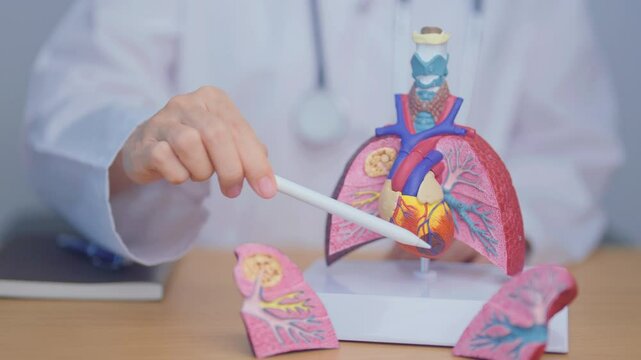 Doctor with Smoker and normal Lung anatomy for Disease. Lung Cancer, Asthma, Chronic Obstructive Pulmonary or COPD, Bronchitis, Emphysema, Cystic Fibrosis, Bronchiectasis, Pneumonia and world Lung day