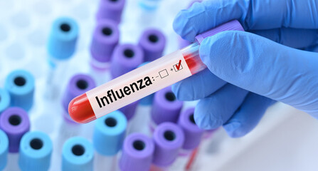 Obraz premium Doctor holding a test blood sample tube with influenza test on the background of medical test tubes with analyzes.