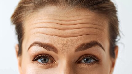 macro image of a senior woman's wrinkled forehead. Age-related deep furrows narrow. The idea of preventing age-related skin changes. Cosmetology techniques to prevent wrinkles and aging.