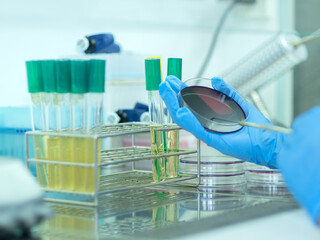 Medical technicians working on bacterial culture and drug resistance of pathogens in laboratory.