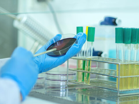 Medical technicians working on bacterial culture and drug resistance of pathogens in laboratory.
