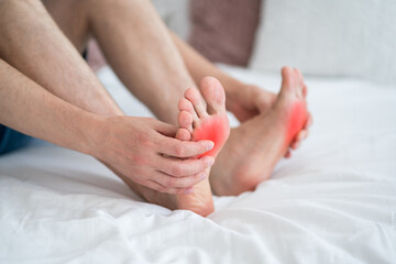 Foot pain, corns and calluses, dry skin on legs, man suffering from feet ache at home