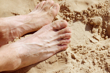 Close-up of feet buried in sand at the beach, highlighting toes with a fusion deformity, depicting relaxation, beach activities, and unique physical traits.