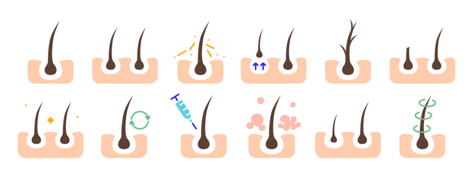 Hair growth set icon. Hair follicle stages, growth cycle, scalp care, injection, dermatology, treatment, hair loss prevention, hair health.