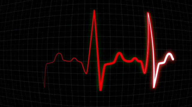 EKG heart beat line monitor. ECG flatline, screen of electrocardiogram machine in close-up, looped seamlessly