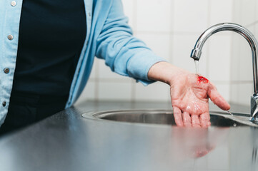 Person washing away dirt and blood from wound in sink