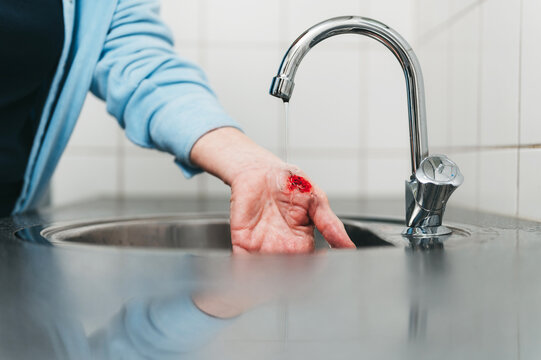 Person washing away dirt and blood from wound in sink