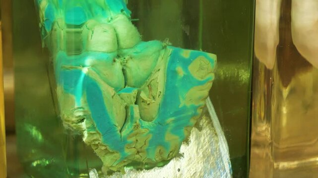Cattle brain. Blue cow brain in flask. Sectional view of cattle brain, anatomy of brain, convolutions of brain, gyri of cerebrum. Animal brain in glass jar with formaldehyde for medical research