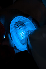 Dentist is whitening teeth of his patient with ultraviolet stomatology hardware. Teeth ultraviolet...