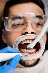 Airflow teeth cleaning process. Dentist removes plaque from teeth with airflow equipment. Dental...