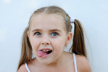 a mischievous, cheerful little girl with freckles rejoices and makes faces