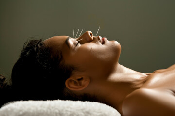 A serene young woman lying down with eyes closed, experiencing a traditional acupuncture therapy session