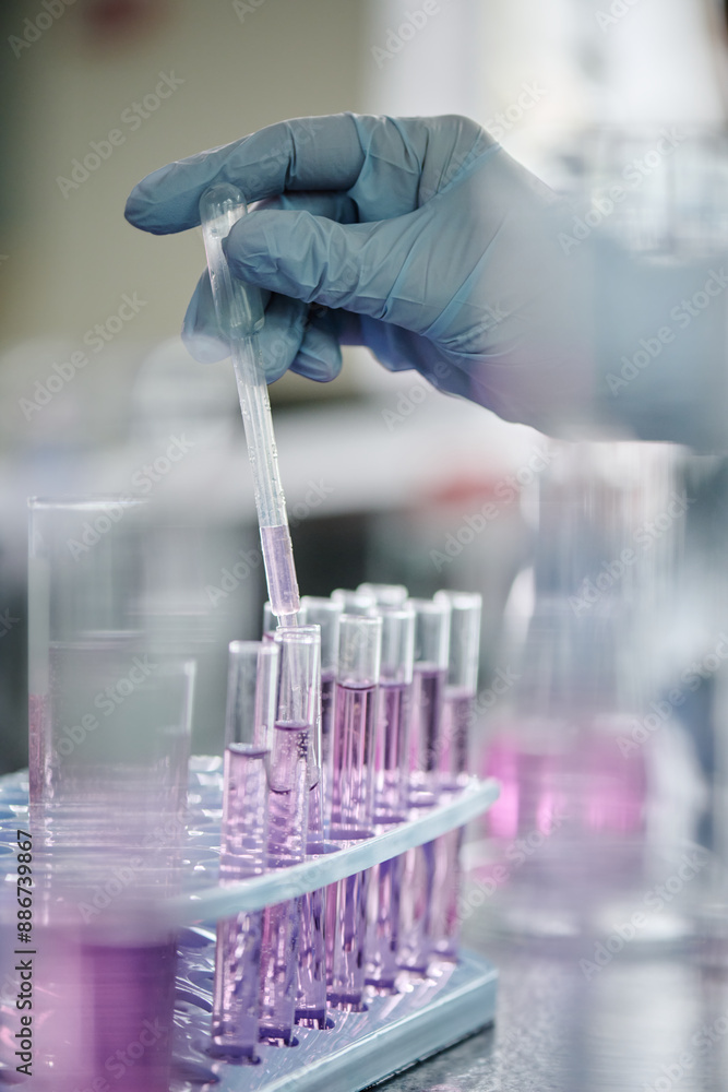 Poster Gloved hand of modern clinician or researcher dropping liquid substance from pipette into one of several flasks during experiment