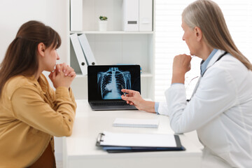 Lung cancer. Doctor showing chest x-ray on laptop to her patient in clinic