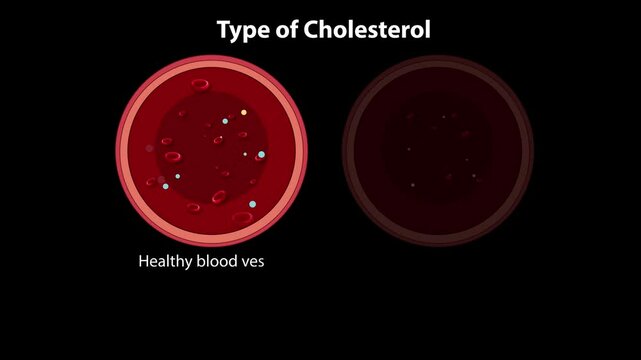 Cholesterol Types and Blood Vessel Health
