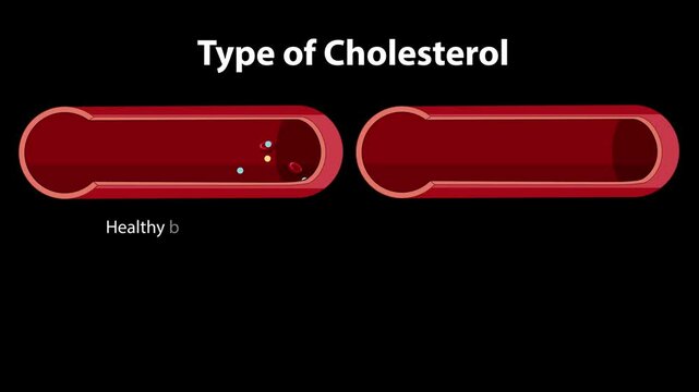 Cholesterol Types and Blood Vessel Health