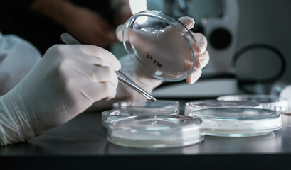 Woman is working with Sclerotinia that is in the rounded containers in the laboratory
