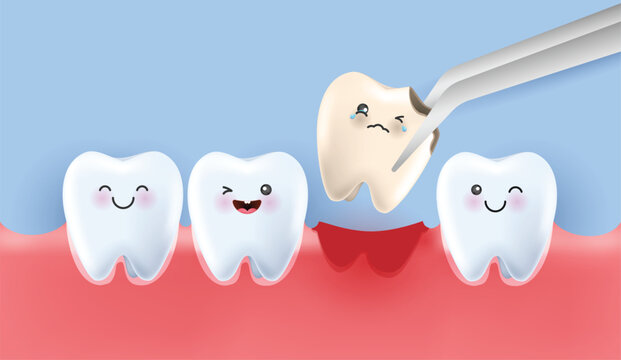 Dental care illustration set. dentists treat  tooth decay to avoid pain when chewing. tooth decay treatment concept. remove plaque, treat tooth decay. medical apps, websites and hospital. vector.