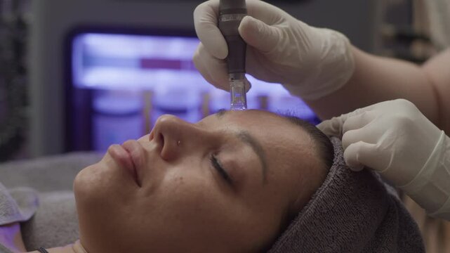 Tilt down shot of young Caucasian woman getting derma stamp procedure to get rid of skin imperfections at clinic