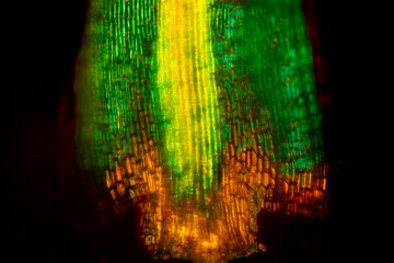 Abstract micrograph of a broom moss leaf, with alar cells.