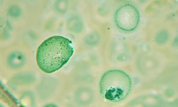  Leaf cells with chloroplasts moving inside microscopic view