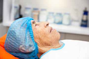Senior adult patient at the dermatologists office being prepared for a biopsy procedure.