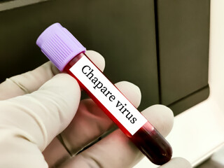 Biological specimen (blood) in vacuum tube for pathological analysis. Medical laboratory various...