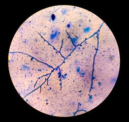 Photomicrograph showing Hyphae of dermatophytes, Nail scraping or skin scraping for fungus test in microbiology laboratory.