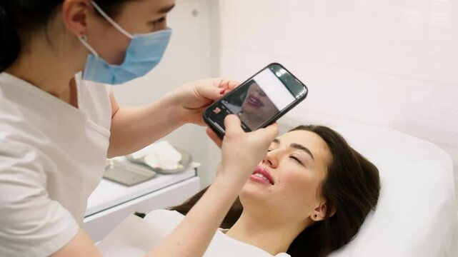 Medical office, a female doctor takes a photo of the patient's lips on the phone, after injecting hyaluronic acid into the lips. Correction of lip shape, demonstration of results, technology.