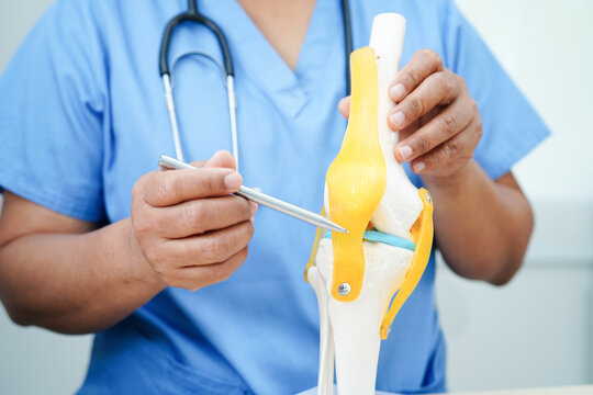 Knee osteoarthritis, Doctor showing model knee joint orthopedic. - Powered by Adobe