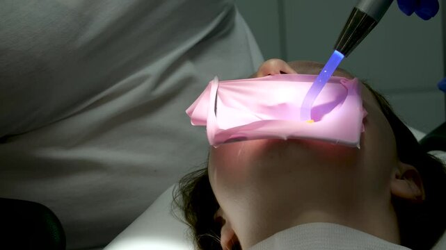 Dentist filling. female dentist examining young girl patient's teeth at dental clinic. Doctor probing teeth with dental instrument using an explorer look for cavities treatment and checking
