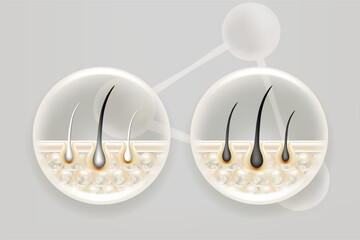 Hyaluronic acid and Niacinamide before and after gray hair and skin solutions ad, white collagen serum drops into skin cell with cosmetic advertising background ready to use, illustration vector.