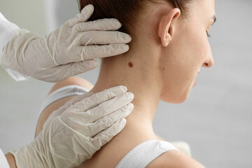 Doctor examining woman's mole in clinic, closeup