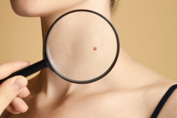 Doctor examining woman's mole with magnifying glass on beige background, closeup