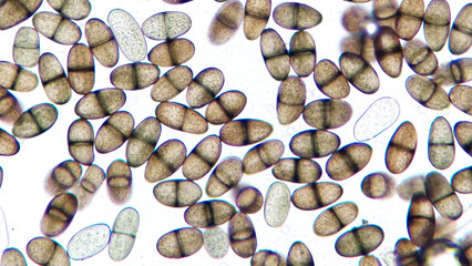 Lasiodiplodia sp. mature conidia. This fungi grow on Pachyrhizus erosus tuber. 400x magnification + 3.5x camera zoom. Live cell. Selective focus image