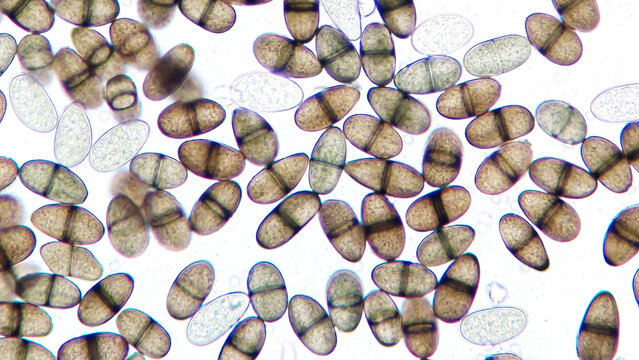 Lasiodiplodia sp. mature conidia. This fungi grow on Pachyrhizus erosus tuber. 400x magnification + 3.5x camera zoom. Live cell. Selective focus image