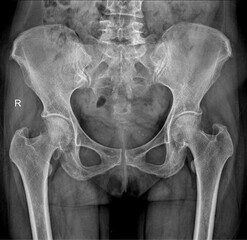 Diverse X-Ray Images: Medical Diagnostics and Healthcare Concepts