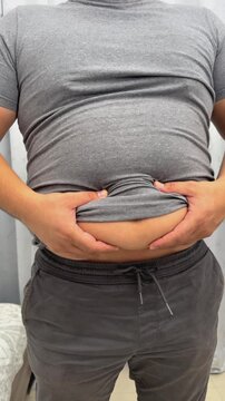 Closeup of fat folds on big belly of overweight woman. Concept of excessive weight, obese female, dieting and overweight problems. High quality 4k footage