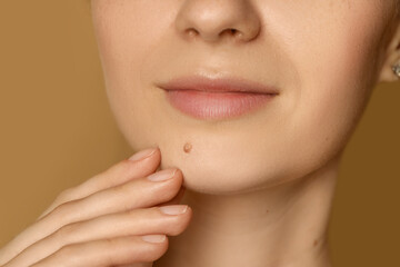 Woman with mole on her skin against beige background, closeup