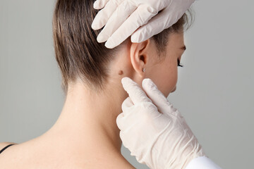 Doctor examining woman's mole in clinic, closeup