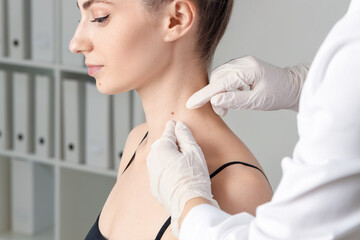 Doctor examining woman's mole in clinic, closeup