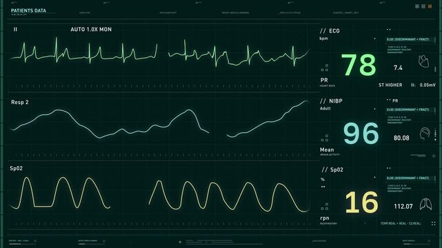 Interface Of Heart Rate Test Equipment Analyzes Patients Health Data. Electrocardiogram Machine Used For Heart Rate Test. Medical Clinic Equipment Testing Heart Rate Of Patient. Evaluating Heartbeat
