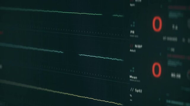 Electronic monitoring system showing the slow decline in the patients heartbeat. Electronic heartbeat device displaying the patients death. Electronic device showing the patients heartbeat flatline.