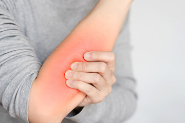 Close-up image of a person in a gray shirt gripping their red irritated arm, showing pain or sensitivity.